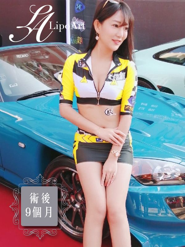 萊波亞