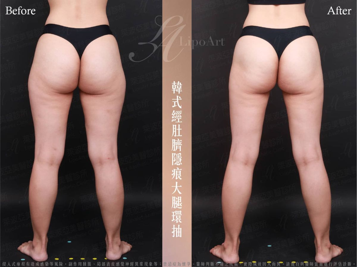 萊波亞 