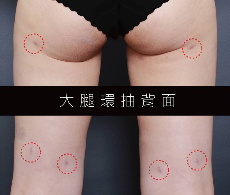 萊波亞