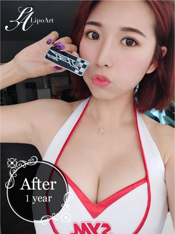 萊波亞