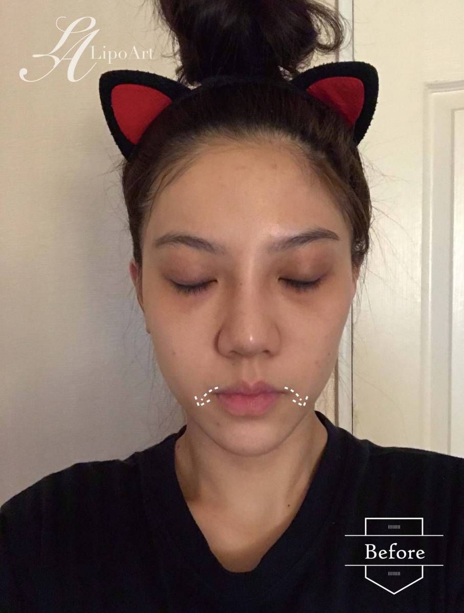 萊波亞