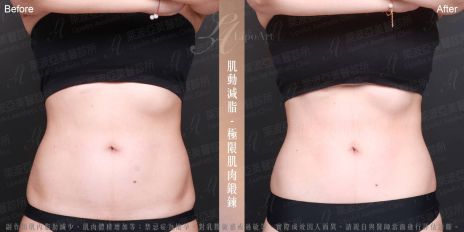 萊波亞