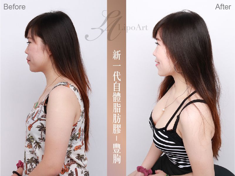 萊波亞