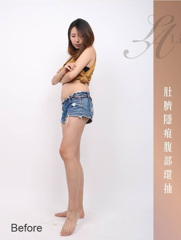 萊波亞