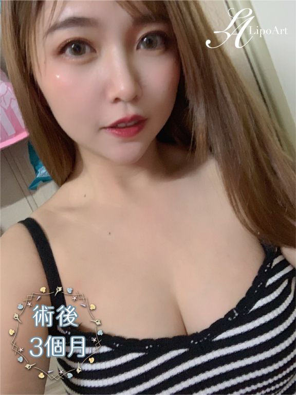 萊波亞