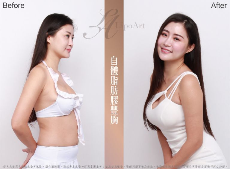 萊波亞