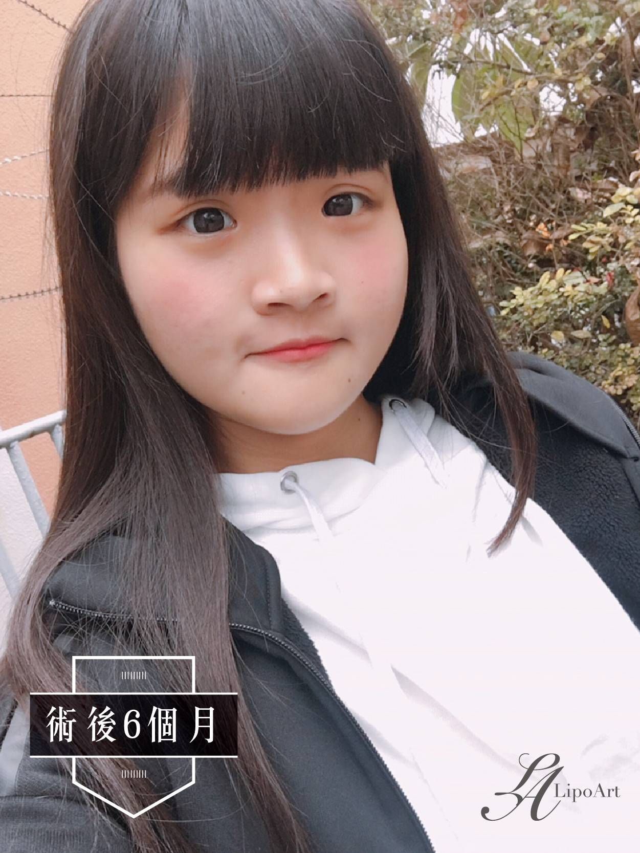 萊波亞