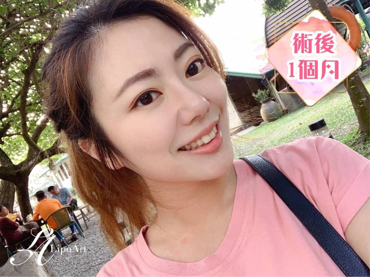 萊波亞