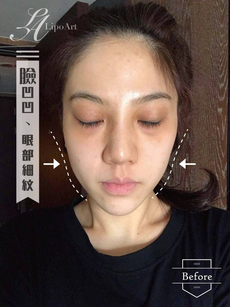 萊波亞