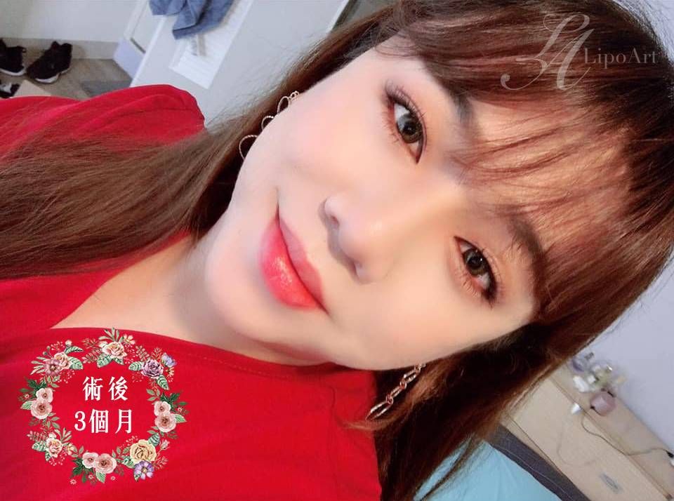 萊波亞