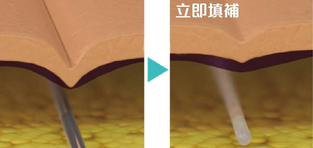 萊波亞