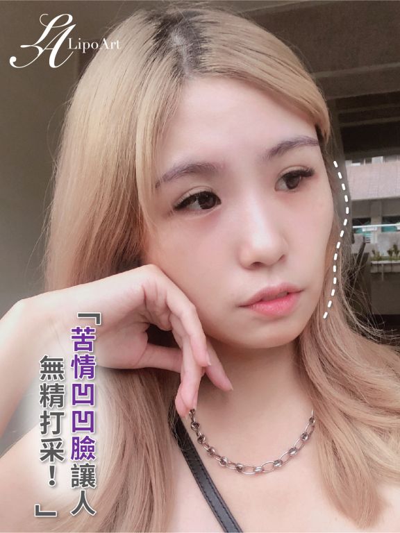 萊波亞