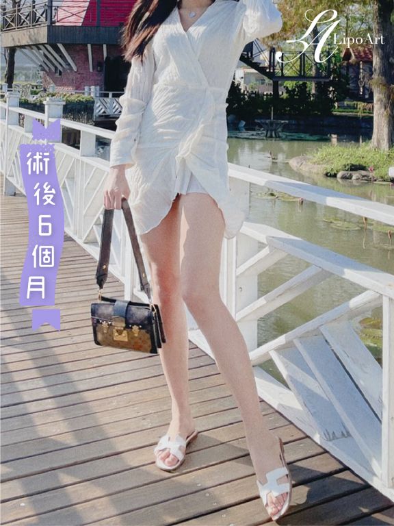 萊波亞