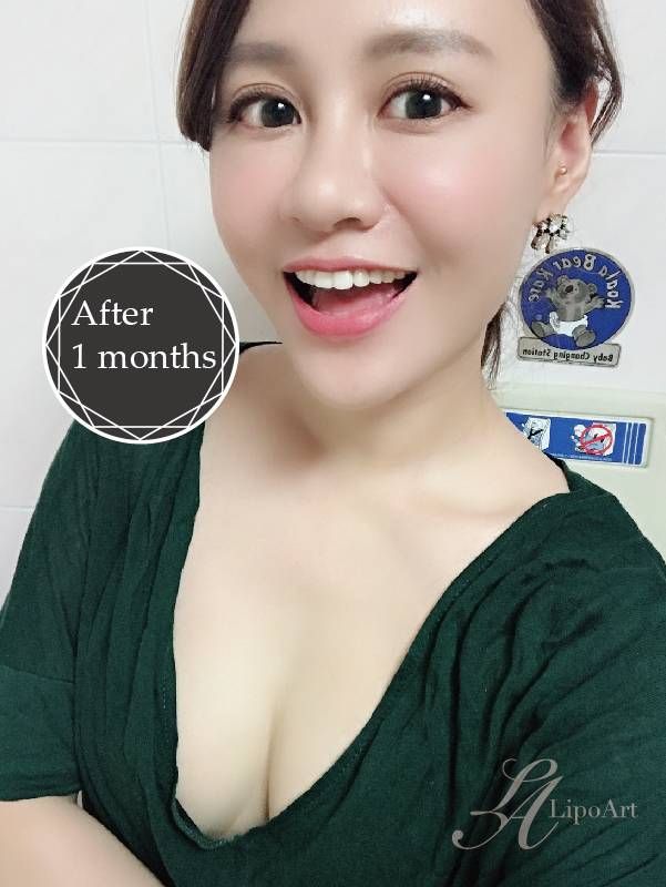 萊波亞