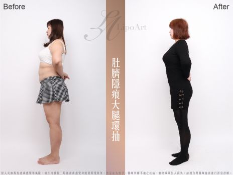 萊波亞