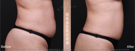 萊波亞 
