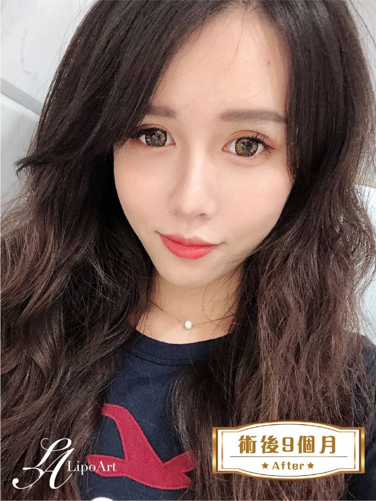 萊波亞