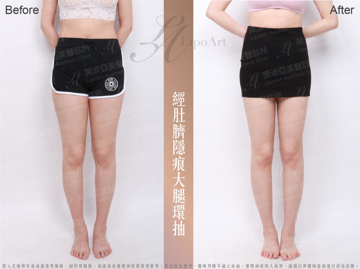萊波亞