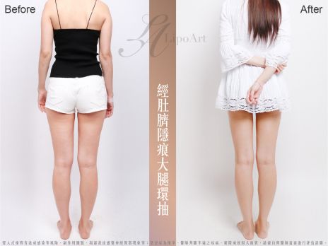 萊波亞 