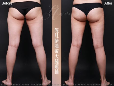 萊波亞 