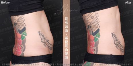 萊波亞 