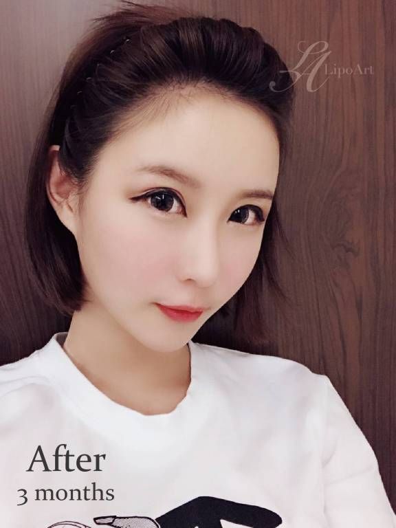 萊波亞