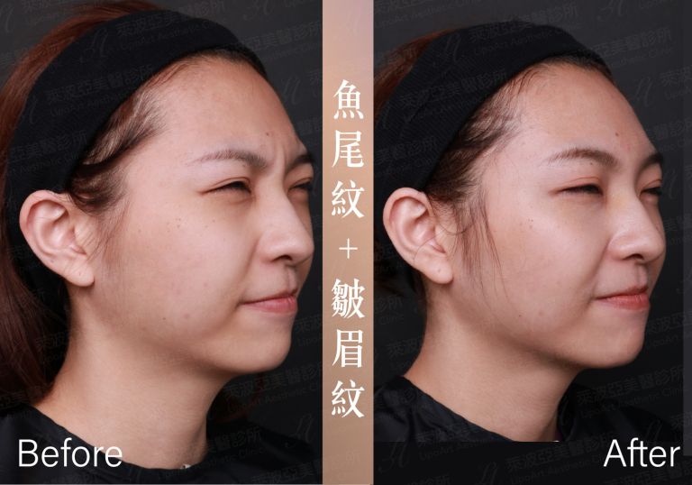 萊波亞