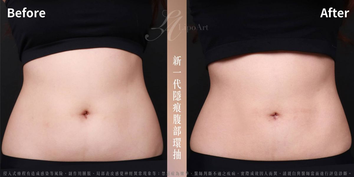 萊波亞
