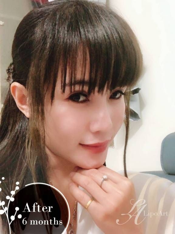 萊波亞
