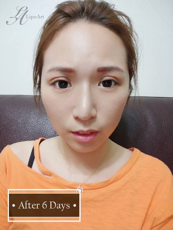 萊波亞