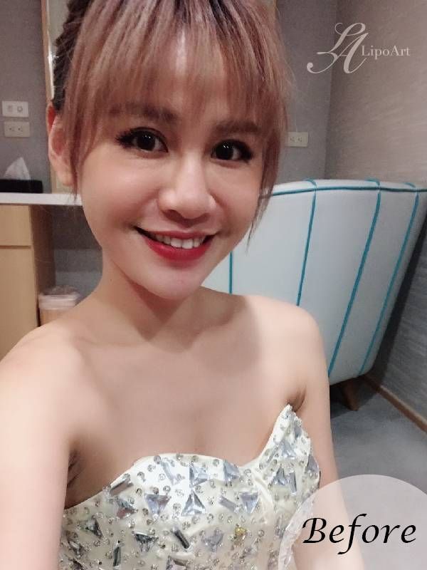 萊波亞