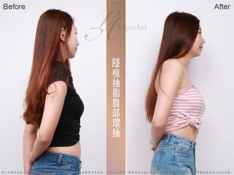 萊波亞 