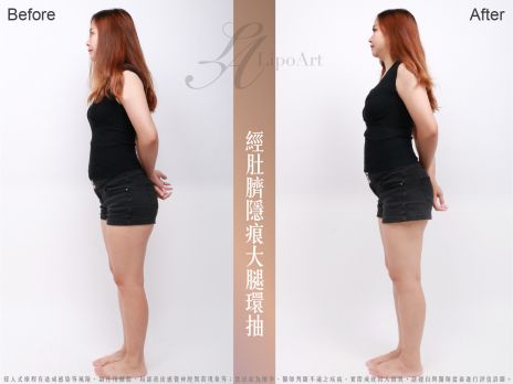 萊波亞 