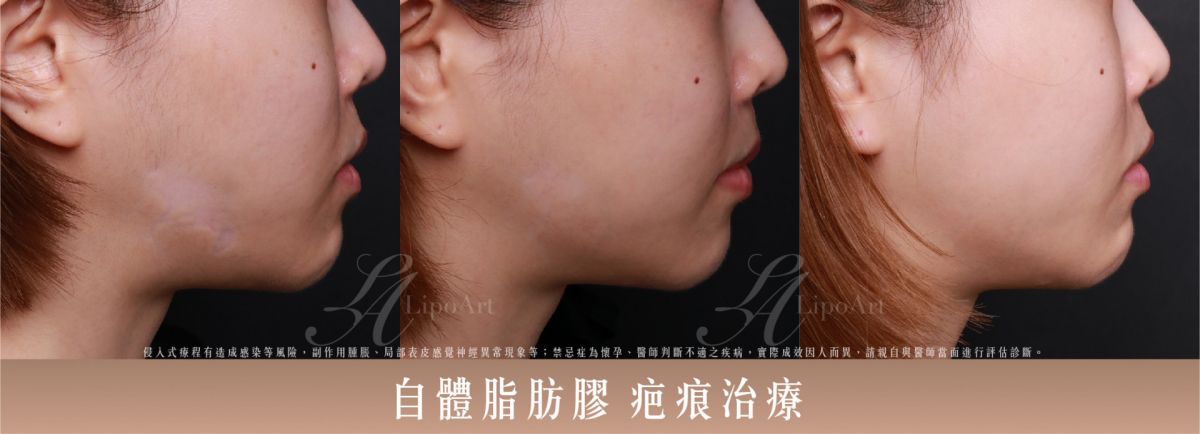 萊波亞