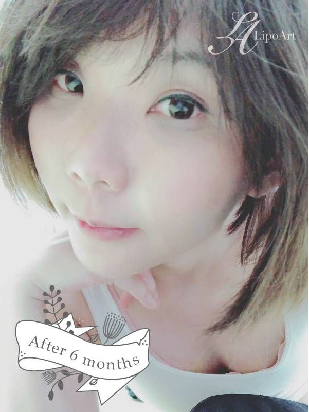 萊波亞