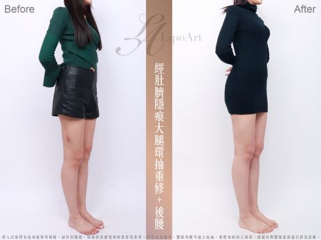 萊波亞 