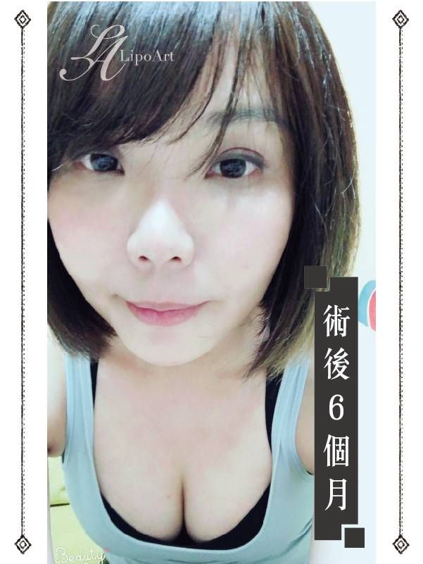 萊波亞