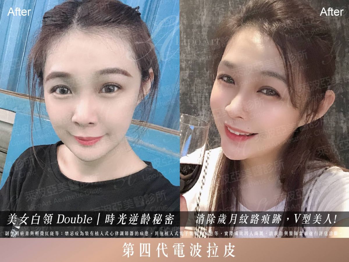 萊波亞