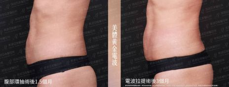 萊波亞 