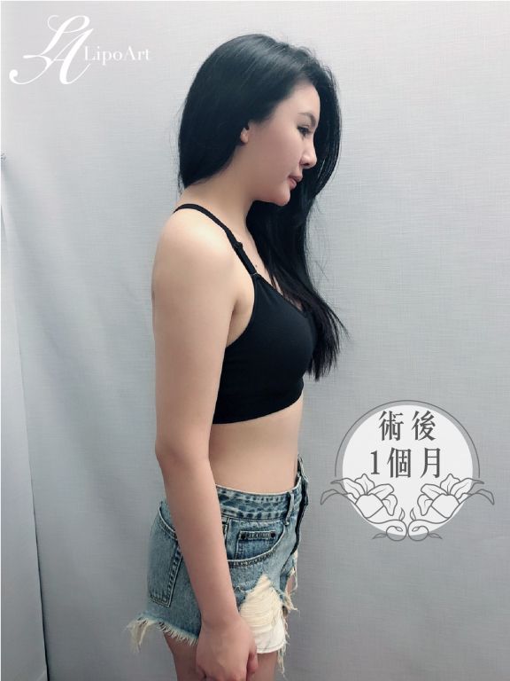 萊波亞