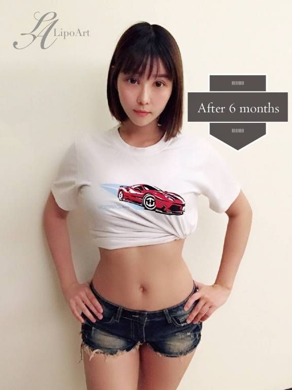 萊波亞