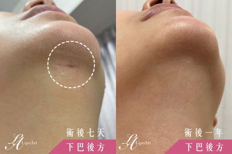 萊波亞