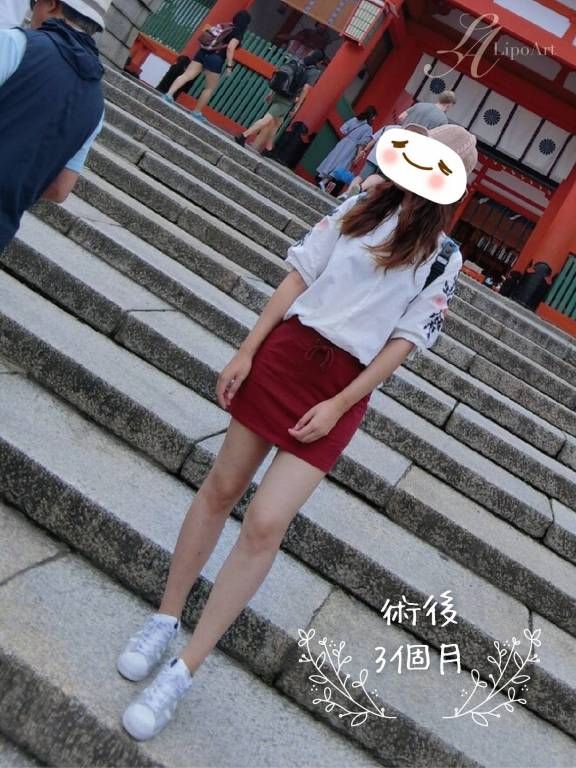 萊波亞