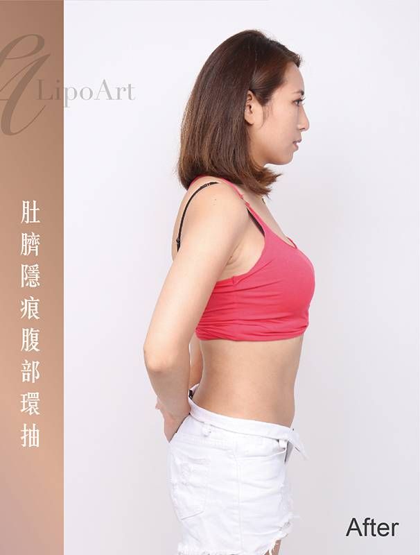 萊波亞