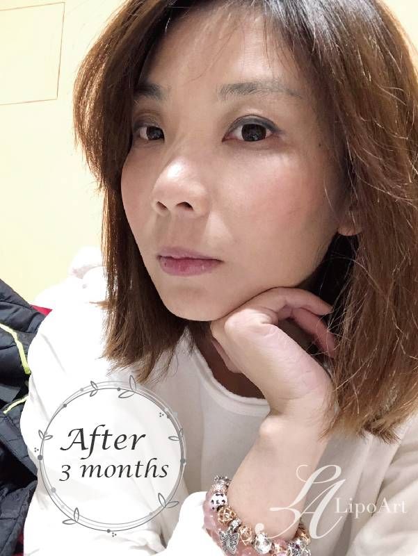 萊波亞