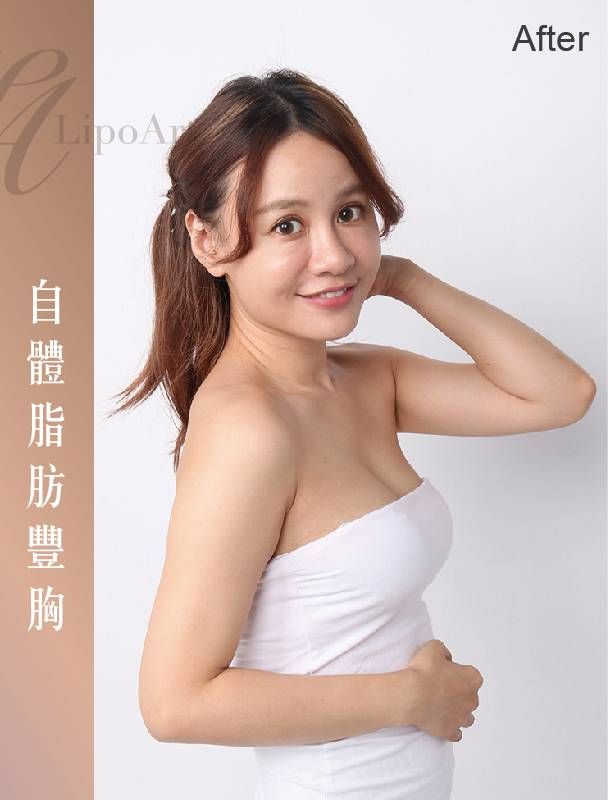 萊波亞 