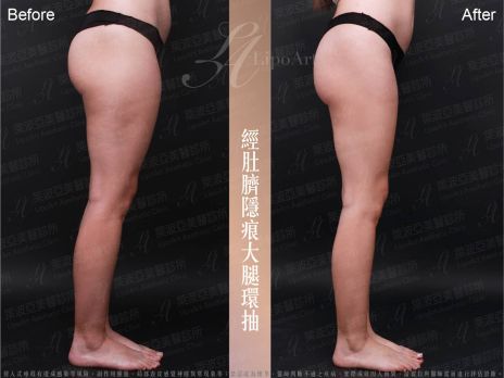 萊波亞 