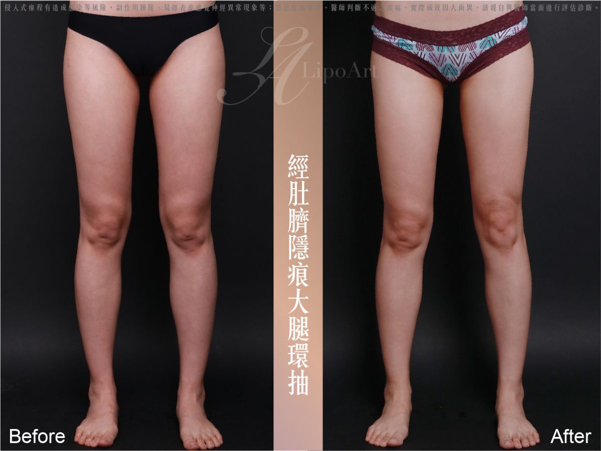 萊波亞