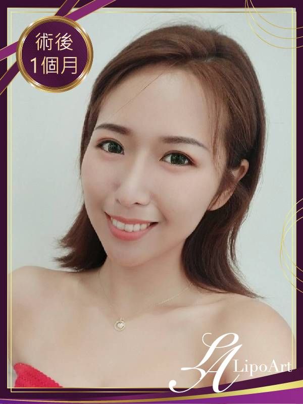 萊波亞