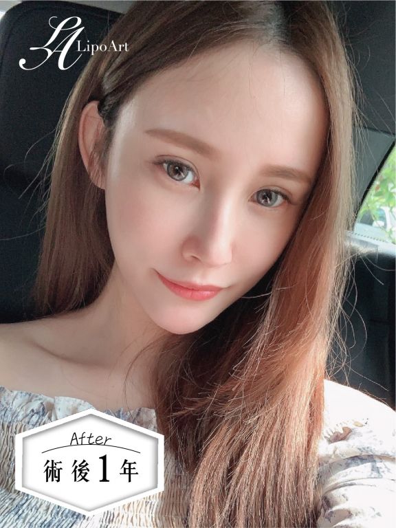萊波亞
